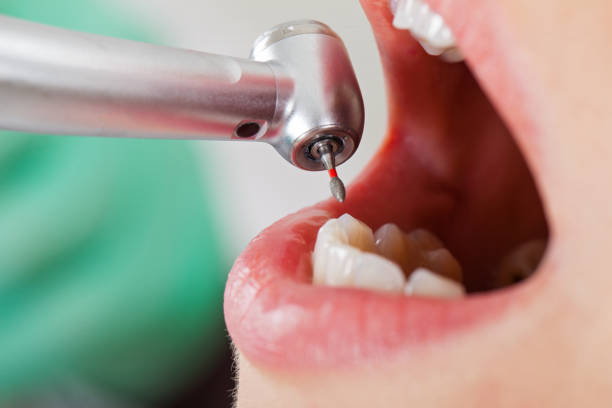 Professional Emergency Dental Service in MD